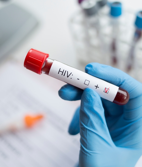 HIV und Hepatitis Testwoche