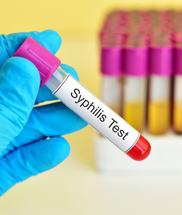 Eine Person hält einen Syphillis-Test.