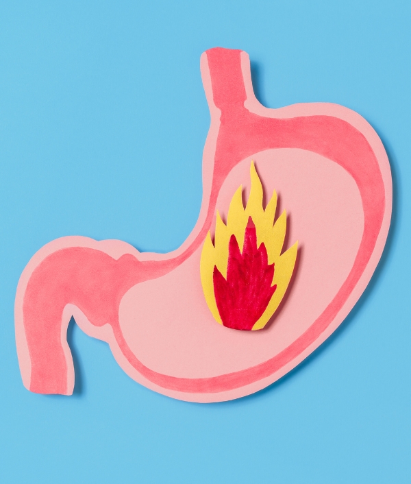 Das Bild zeigt einen aus Karton dargestellten Magen mit einer Flamme. Es symbolisiert Sodbrennen.