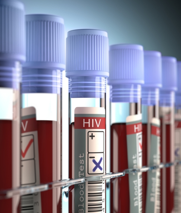 Das Bild zeigt Blutabnahmeröhrchen mit HIV-positivem Blut.