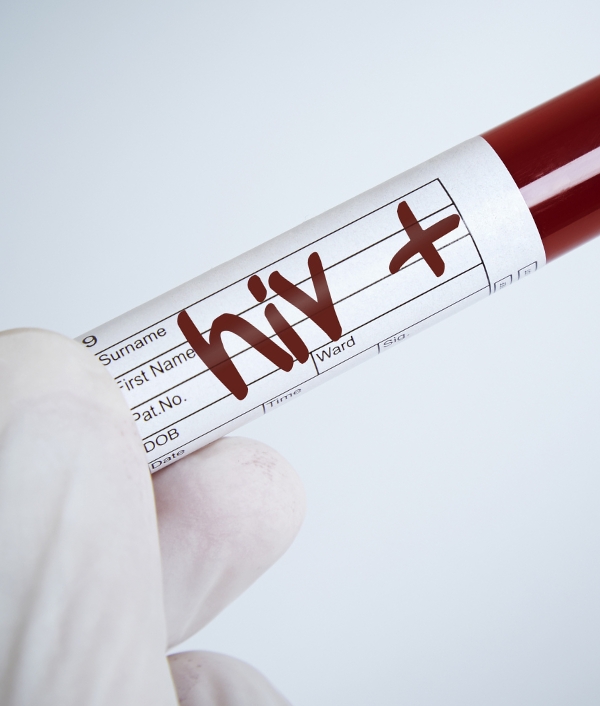 Das Bild zeigt ein Blutabnahmeröhrchen. Darauf steht das Wort HIV + geschrieben.
