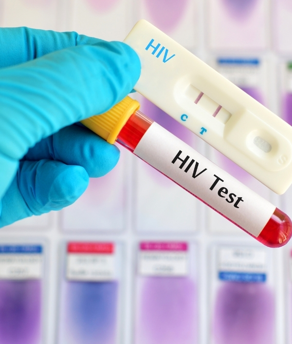 Das Bild zeigt eine Person mit blauen Latexhandschuh die einen HIV Schnelltest hält.