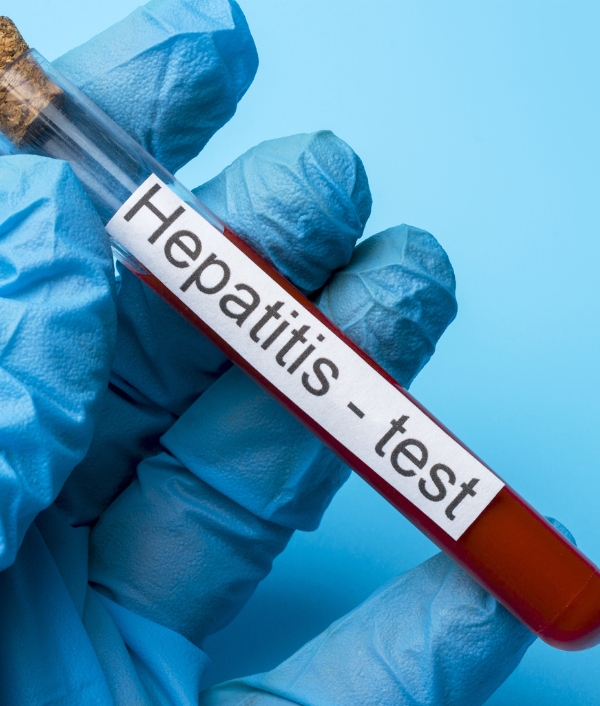 Hepatitis 3