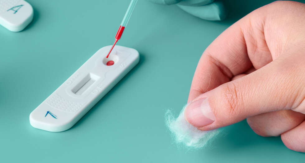 STD rapid test in the Johann Strauss Pharmacy Vienna