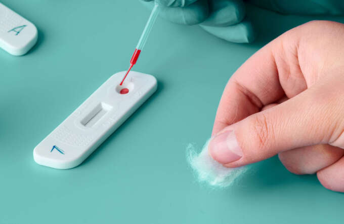 STD Schnelltest in der Johann Strauss Apotheke Wien