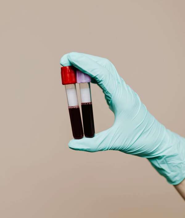 std-test-blut std-test-blut