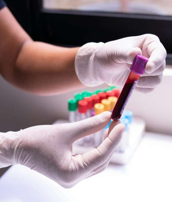 stds-test-johann-strauss-apotheke-2 stds-test-johann-strauss-apotheke-2