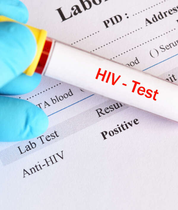 © Canva HIV Schnelltest