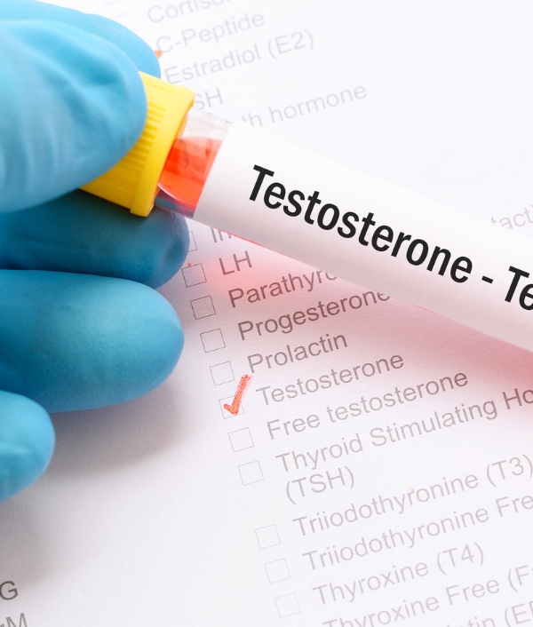Testosteron_Johann Strauss Apotheke Wien Testosteron Johann Strauss Apotheke Wien