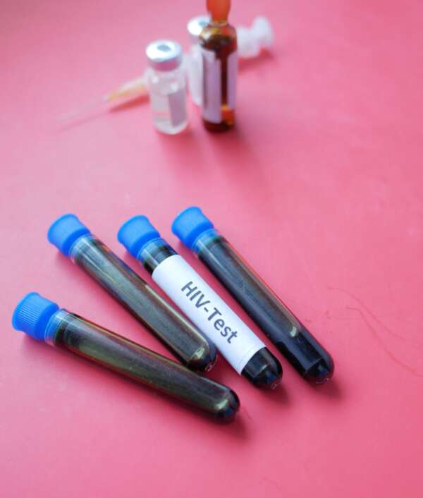 hiv-hızlı-test_johann-strauss-eczanesi hiv-hızlı-test_johann-strauss-eczanesi